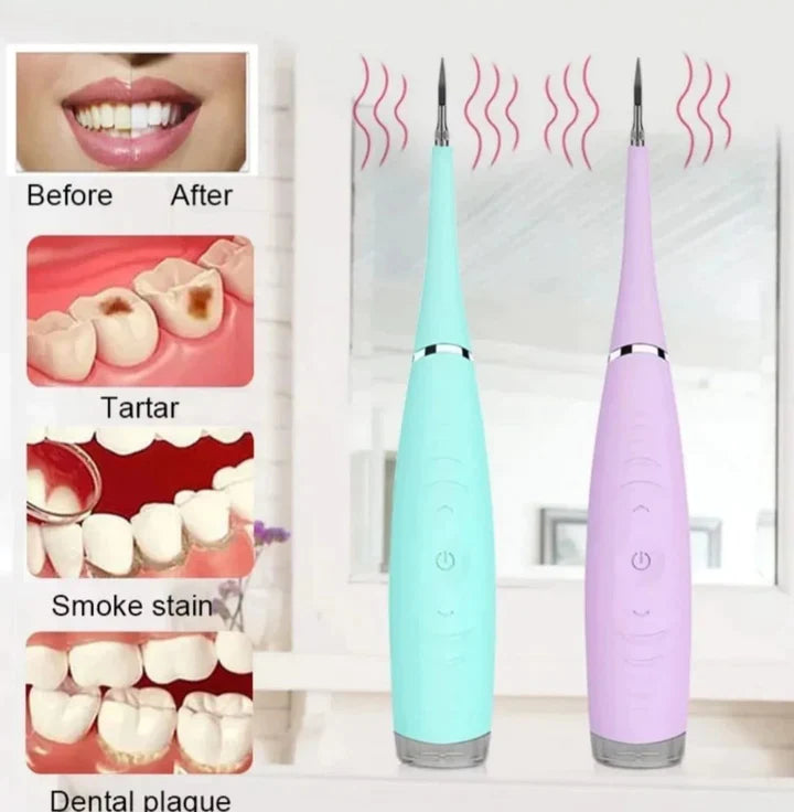 ElectricCleaner™ - Limpiador De Sarro Dental